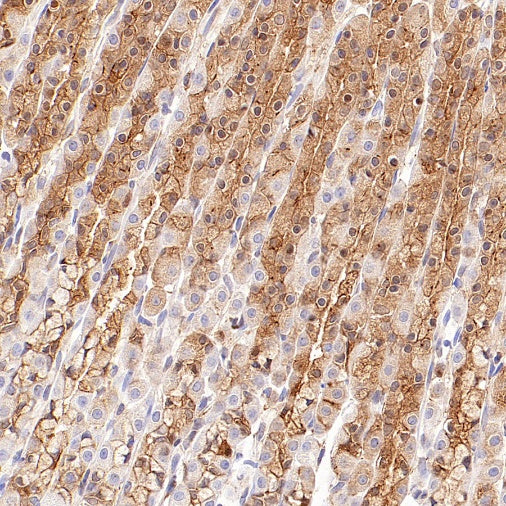 IMPDH2 Rabbit Polyclonal Antibody
