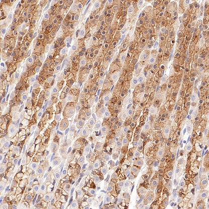 IMPDH2 Rabbit Polyclonal Antibody