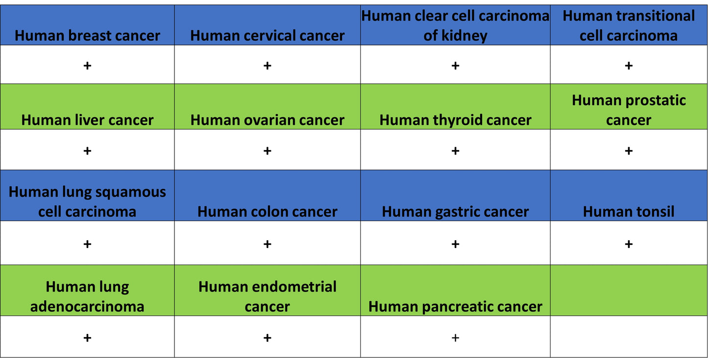 COL3A1 Recombinant Rabbit mAb (S-4338)