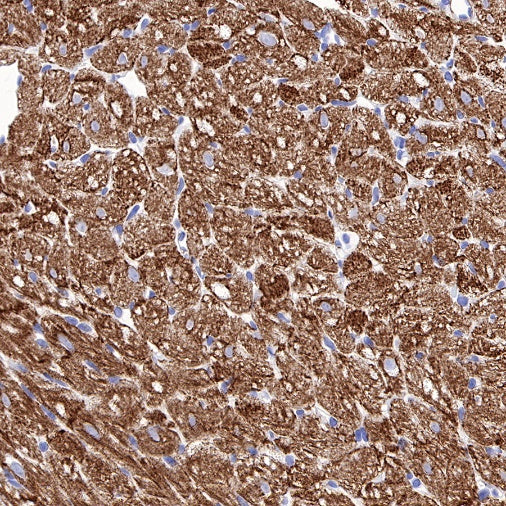 S-RMab® Desmin Recombinant Rabbit mAb (SDT-109-114)