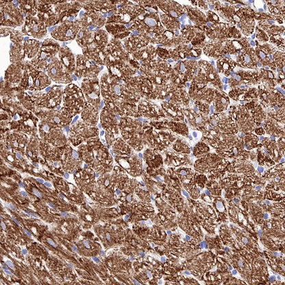 S-RMab® Desmin Recombinant Rabbit mAb (SDT-109-114)