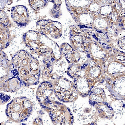 Hamartin/TSC1 Recombinant Rabbit mAb (S-2725-166)