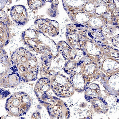 Hamartin/TSC1 Recombinant Rabbit mAb (S-2725-166)