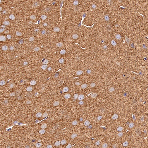 Beta IV Tubulin Rabbit polyclonal antibody