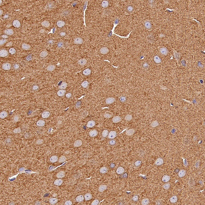 Beta IV Tubulin Rabbit polyclonal antibody