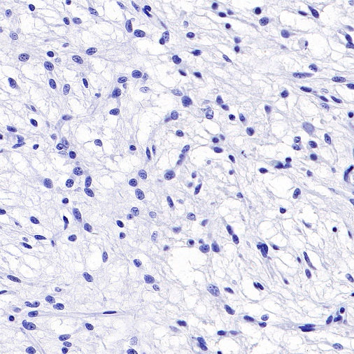 TMEM16A Recombinant Rabbit mAb (SDT-2179-68)