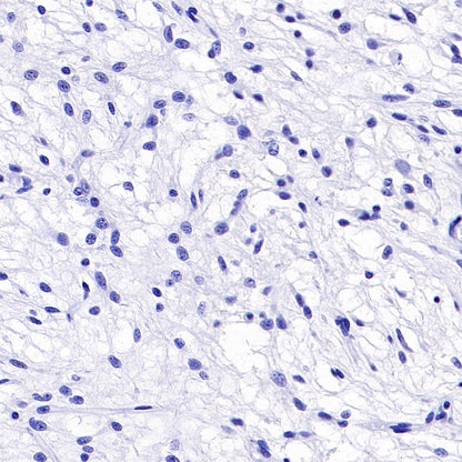 TMEM16A Recombinant Rabbit mAb (SDT-2179-68)