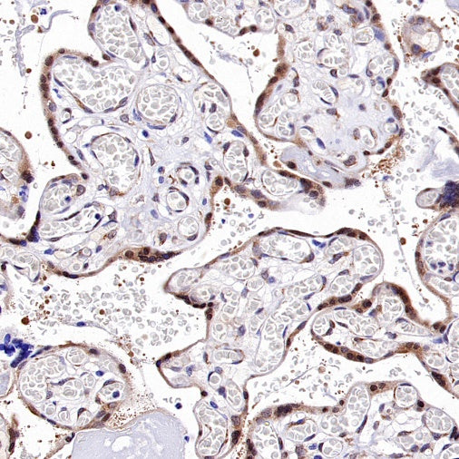 Argonaute 2 Recombinant Rabbit mAb (S-2620-13)