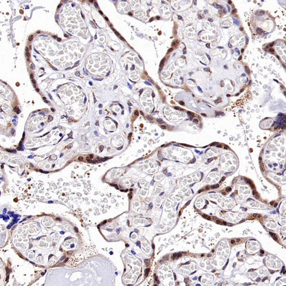 Argonaute 2 Recombinant Rabbit mAb (S-2620-13)