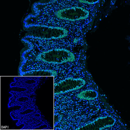 PABPN1 Rabbit Polyclonal Antibody