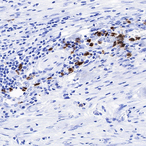 CD66b Recombinant Rabbit mAb (S-766-55)