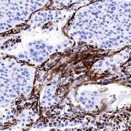Vimentin Recombinant Rabbit mAb (SDT-029-120)