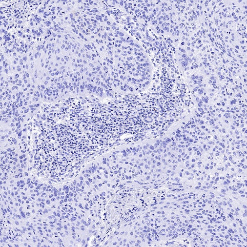 CD133 Recombinant Rabbit mAb(SDT-1295-22)