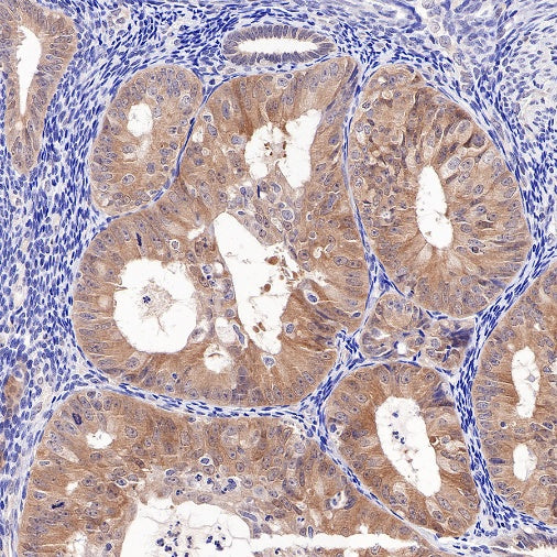 IDH1 Recombinant Rabbit mAb (S-792-16)