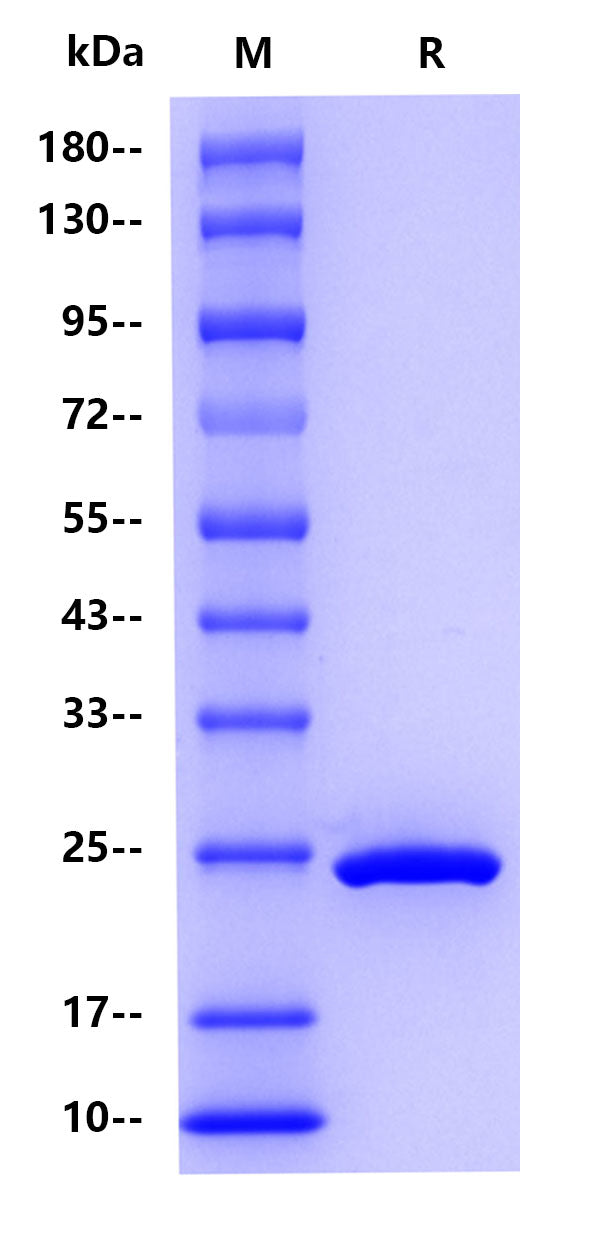 Schistosoma japonicum GST Protein, His Tag