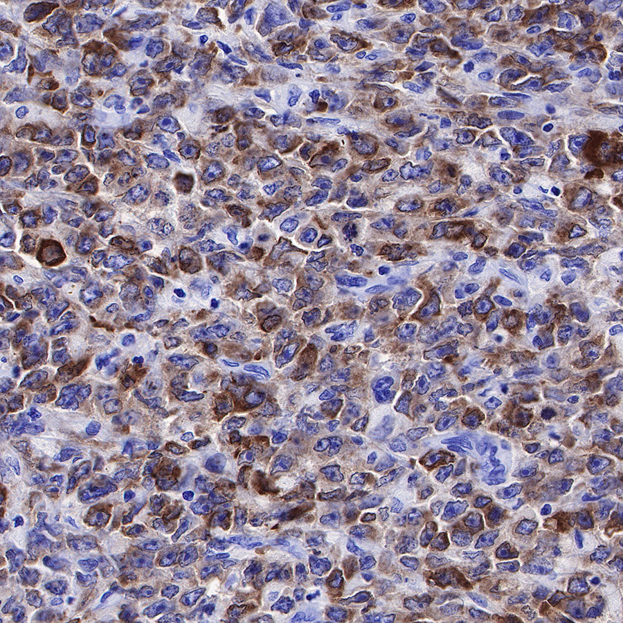 CD79a/MB-1 Recombinant Rabbit mAb (SDT-030-18)