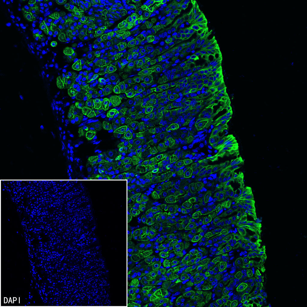 Cytokeratin 7 Recombinant Rabbit mAb (S-5954)