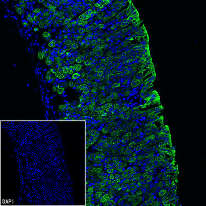 Cytokeratin 7 Recombinant Rabbit mAb (S-5954)