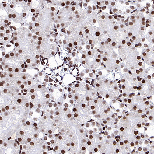SIRT1 Recombinant Rabbit mAb (S-1886-15)