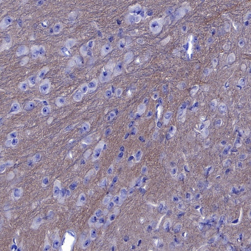 SLIT2 Recombinant Rabbit mAb (S-730-41)