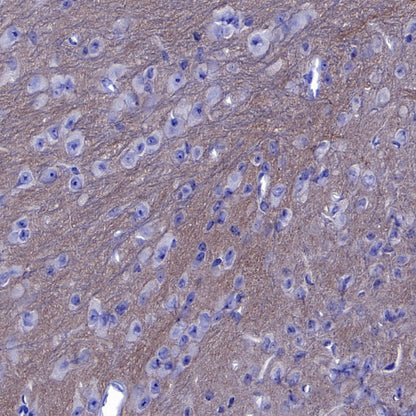 SLIT2 Recombinant Rabbit mAb (S-730-41)