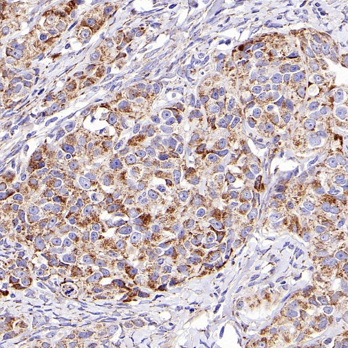 SLC25A22 Recombinant Rabbit mAb (S-2780-15)