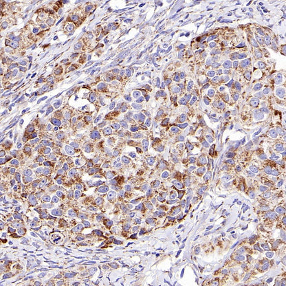 SLC25A22 Recombinant Rabbit mAb (S-2780-15)