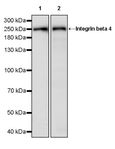 Integrin beta 4 Recombinant Rabbit mAb (S-1625-170)