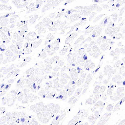 EBV Induced Gene 2/EBI2 Recombinant Rabbit mAb (S-5946)