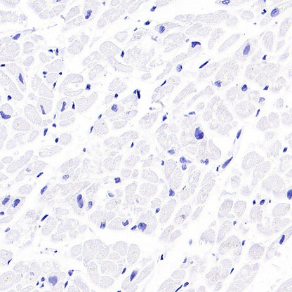 EBV Induced Gene 2/EBI2 Recombinant Rabbit mAb (S-5946)