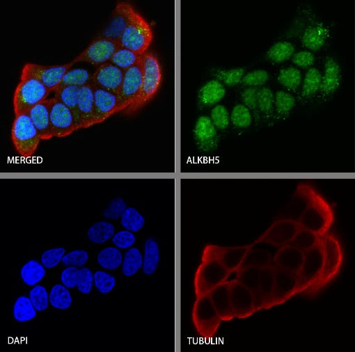 ALKBH5 Recombinant Rabbit mAb (S-2264-39)