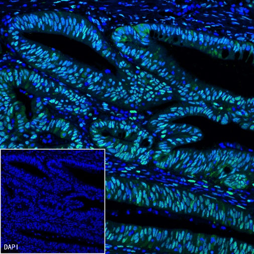 PRMT1 Recombinant Rabbit mAb (S-884-10)