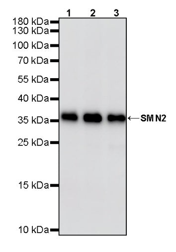 SMN2 Recombinant Rabbit mAb (S-4920-4)