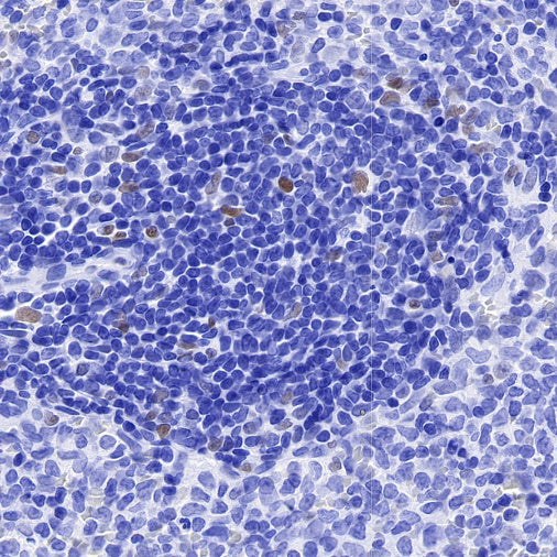 JunB Recombinant Rabbit mAb (S-670-242)
