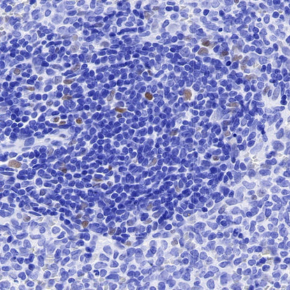 JunB Recombinant Rabbit mAb (S-670-242)