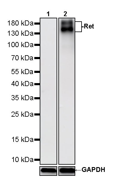 Ret Recombinant Rabbit mAb (S-5298)