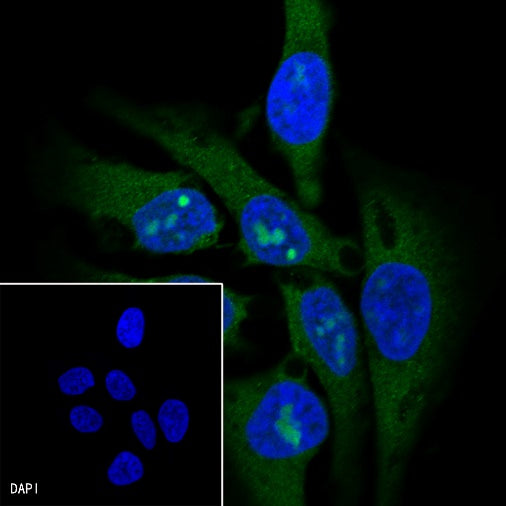 IκBα Recombinant Rabbit mAb (SDT-457-9)