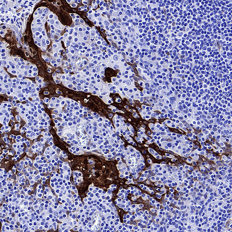 Phospho-HSP27 (Ser82) Recombinant Rabbit mAb (S-4792)