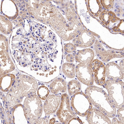 TRAF6 Recombinant Rabbit mAb (S-1087-44)
