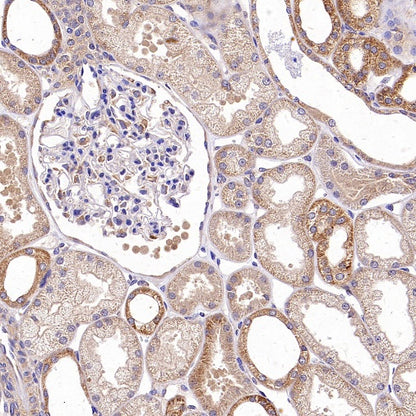 TRAF6 Recombinant Rabbit mAb (S-1087-44)