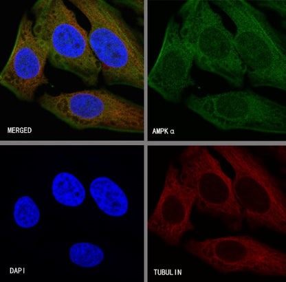 AMPKα Recombinant Rabbit mAb (S-455-38)