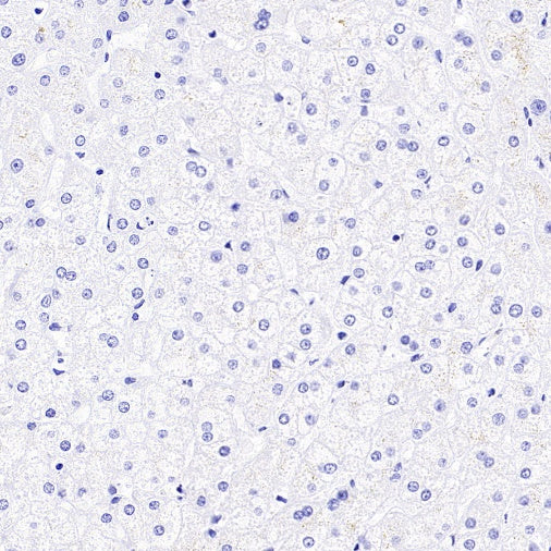 AKAP4 Recombinant Rabbit mAb (SDT-4196)