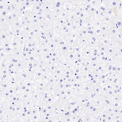 AKAP4 Recombinant Rabbit mAb (SDT-4196)