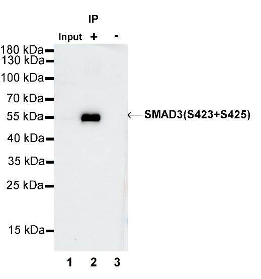SMAD3 (phospho S423+S425) Recombinant Rabbit mAb (S-541-321)