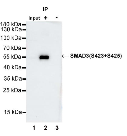 SMAD3 (phospho S423+S425) Recombinant Rabbit mAb (S-541-321)