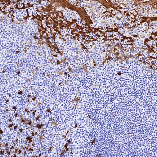 S100A8/MRP8 Recombinant Rabbit mAb (S-R251)