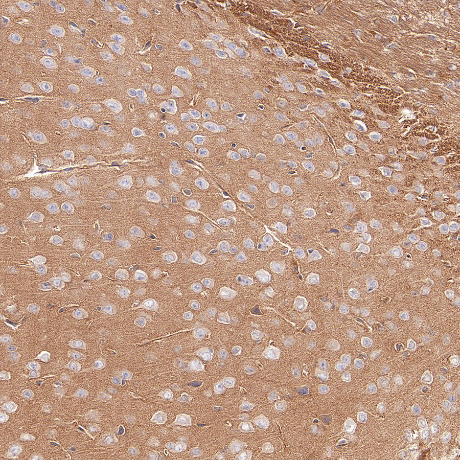 KLC1 Recombinant Rabbit mAb (S-4556-8)