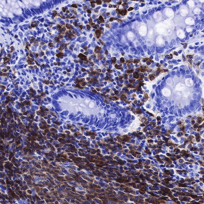 CD79a/MB-1 Recombinant Rabbit mAb (SDT-030-18)