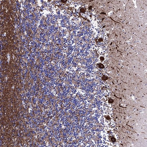 Neurofilament M Recombinant Rabbit mAb (S-501-31)
