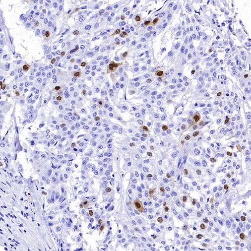 Cyclin A2 Recombinant Rabbit mAb (S-2554-2)